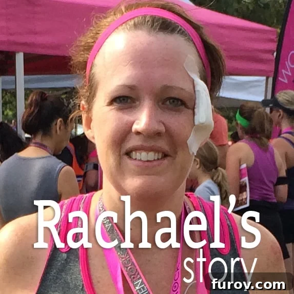 Rachael smiling post-race, wearing a large bandage on her face, with her four daughters