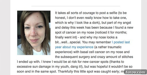 Essential Suncare Updates for Skin Cancer Prevention 3 Close up of a woman