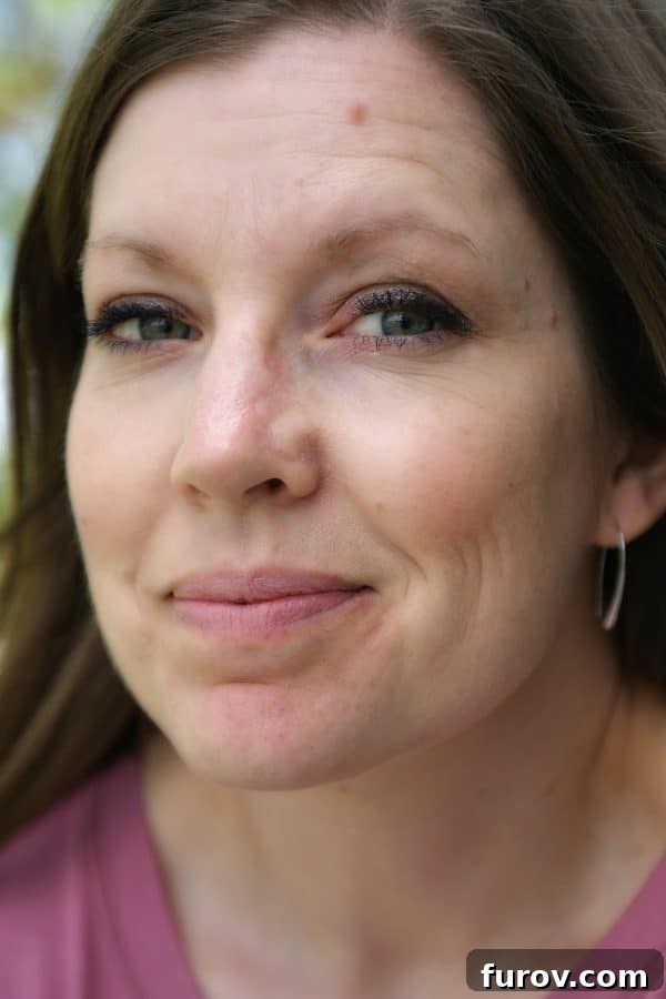 Sun Smart: A Skin Cancer Update & My Favorite Protective Gear 4 A person smiling with a visible scar on their nose, showing ongoing recovery