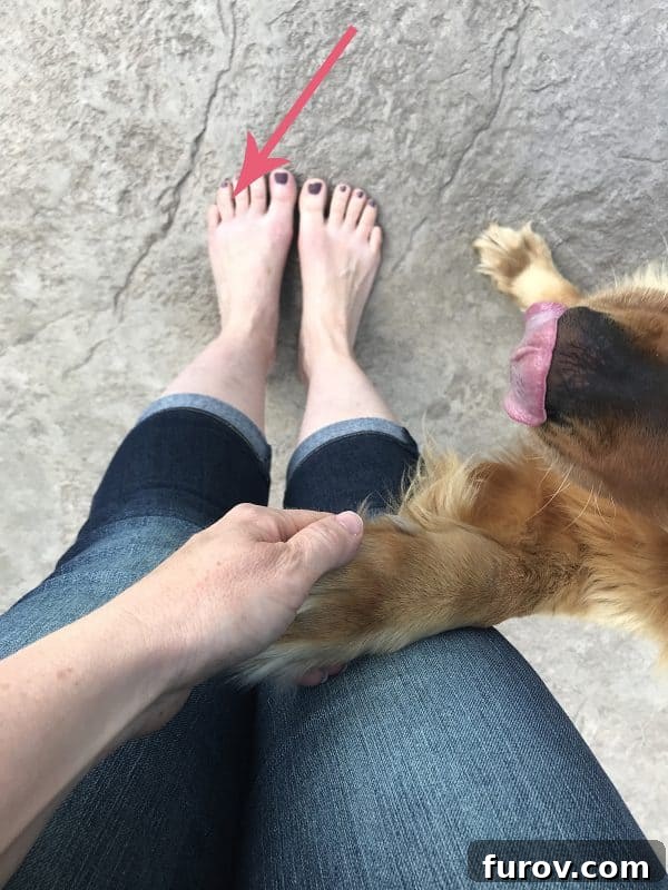 Sun Smart: A Skin Cancer Update & My Favorite Protective Gear 5 A close-up image of a toe, likely showing the area of concern mentioned in the text